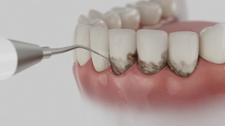 Trusted Teeth Cleaning And Checkup service in Tye, TX - Dentist Open Now